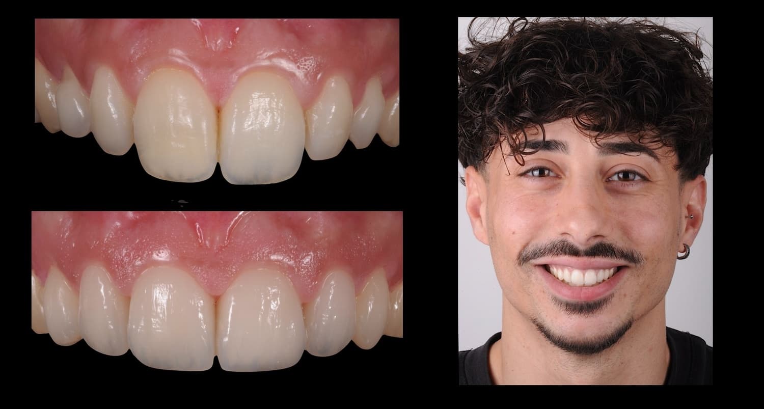 Denti veri. Pazienti veri.